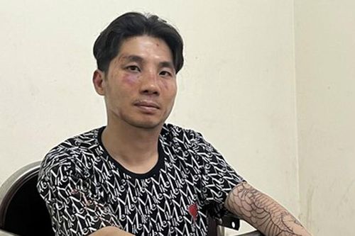 Tạm giữ hình sự thanh niên đâm trung tá công an để điều tra 2 tội danh