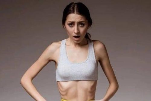 Người béo hay gầy dễ bị đột quỵ?