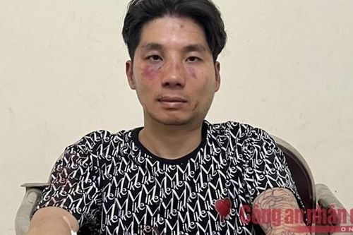 Đối tượng đâm trọng thương Công an bị tạm giữ về hành vi cướp tài sản, chống người thi hành công vụ