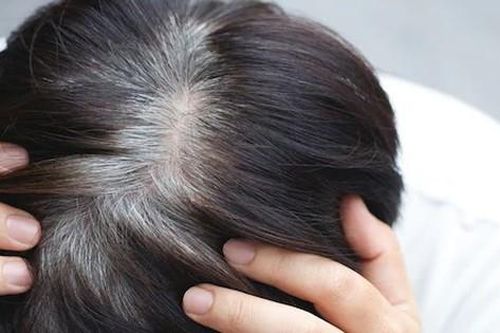 5 nguyên liệu tự nhiên giúp cải thiện tóc bạc sớm