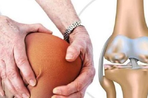 1 tỷ người sẽ bị thoái hóa khớp vào năm 2050, phòng ngừa thế nào?