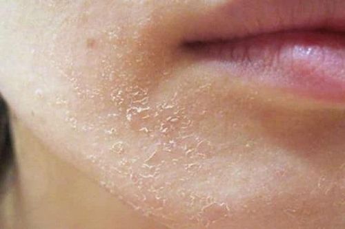 Cách giúp da khỏe mạnh, mềm mại trong mùa đông