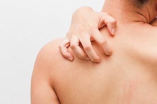 Làm gì để không bị ngứa và dị ứng da vào mùa đông, khi thời tiết lạnh và hanh khô