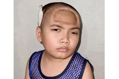 Nhà nghèo, con trai bị u não