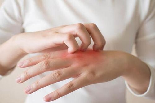 Có tới 5 nguyên nhân gây ngứa khi trời lạnh nhưng cách xử lý lại cực đơn giản