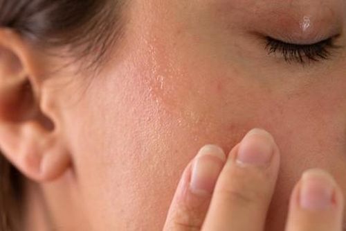 10 nguyên nhân gây khô da và cách khắc phục