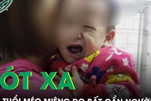 Xót xa bé 2 tuổi bị méo miệng vì bố mẹ chở đi chơi bằng xe máy vào tối muộn