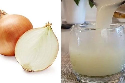 Tác dụng của nước ép hành tây