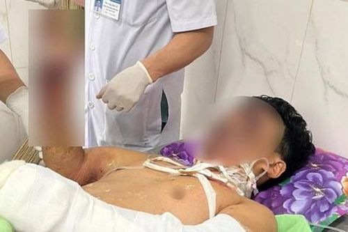 Mất mạng, cụt tay chân, mù mắt...vì pháo