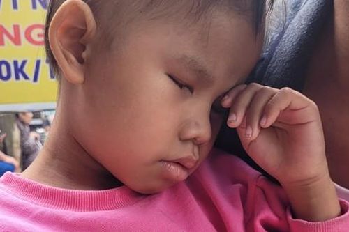 Sức khỏe của cô bé Minh Anh bị u võng mạc đã tiến triển tốt