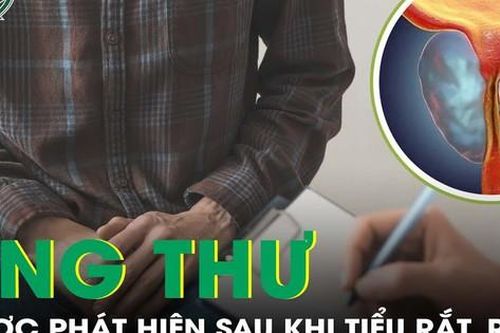 Sốc nặng khi bác sĩ kết luận ung thư tuyến tiền liệt dù khỏe mạnh