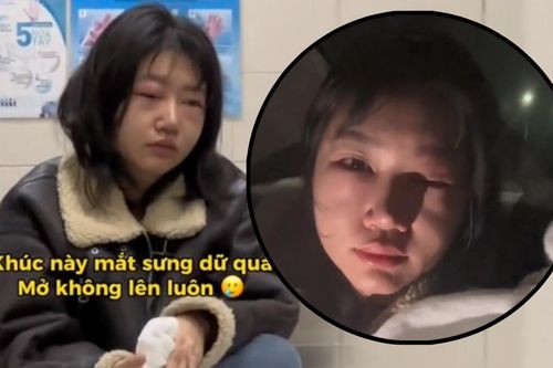Nữ ca sĩ khóc nấc vì lo lắng khi đôi mắt sưng húp ngay sát giờ diễn, lên đường đi cấp cứu ngay trong đêm
