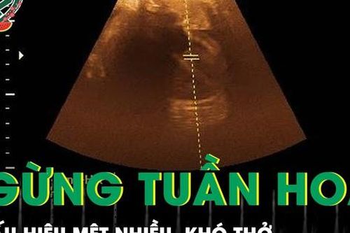 Mệt nhiều, khó thở bệnh nhân nguy kịch ngừng tuần hoàn do rối loạn nhịp tim