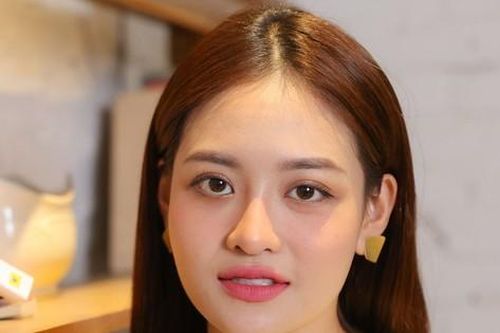 Thùy Anh: 'Tôi bị miệt thị, họ gọi tôi là quái vật'