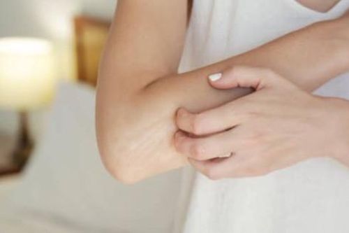 Ứng phó với ngứa da trong thời tiết lạnh