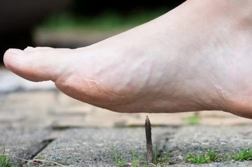 Nguy cơ nhiễm uốn ván khi giẫm vật này trên đường