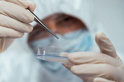 Chứng kiến vợ đi nhà nghỉ với trai lạ, ông bố lấy tóc con xét nghiệm ADN