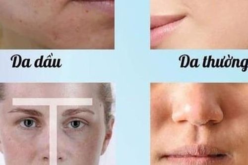 5 bước chăm sóc da cơ bản giúp da hết nhăn nheo