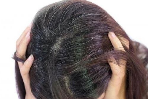 Nguyên nhân 4 vị trí tóc bạc nhiều và gợi ý cách khắc phục