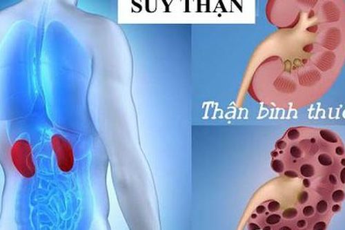 Tiết lộ 3 thói quen xấu khiến nữ Tiktoker xinh đẹp mắc suy thận độ 3, chuyên gia khuyến cáo giới trẻ nên duy trì thói quen này để phòng bệnh!