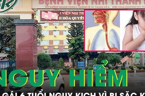 Bé gái 6 tuổi nguy kịch vì bị sặc kẹo