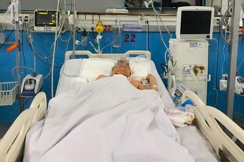 Cắt khối bướu giáp dài 9 cm cho bệnh nhân ở TP.HCM