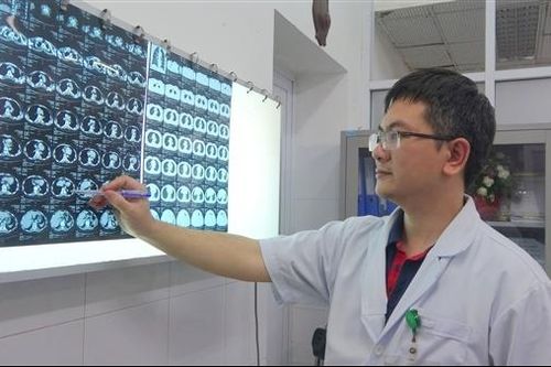 Phẫu thuật thành công ca phổi trong phổi đặc biệt hiếm gặp
