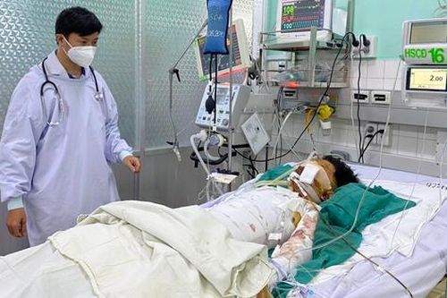 2 thiếu niên nguy kịch vì học chế tạo pháo bằng máy xay sinh tố