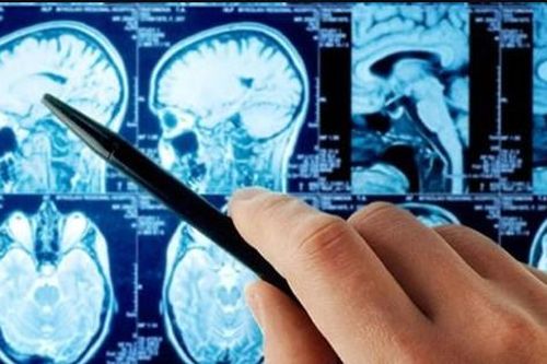 Phát hiện có khối u nguy hiểm nhờ những bức ảnh cũ