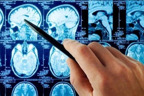 Phát hiện có khối u nguy hiểm ở não nhờ xem ảnh chụp 8 năm trước