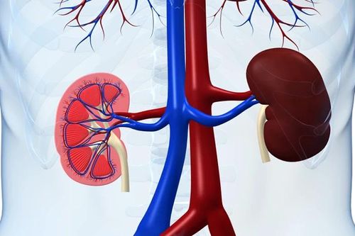 Vì sao bệnh viêm cầu thận là nguyên nhân hàng đầu dẫn đến suy thận?