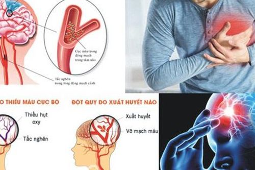 Người đàn ông đột ngột qua đời do chủ quan với căn bệnh phổ biến này suốt 5 năm