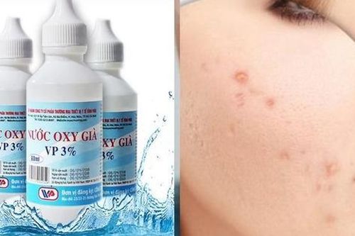 Cách sử dụng oxy già trong chăm sóc da