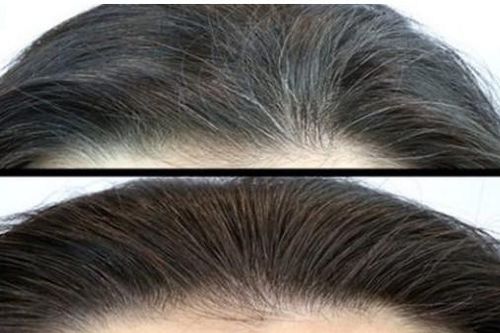 Khế giã nhuyễn trộn cùng nước dừa bôi lên đầu: Tóc xơ rối, bạc trắng cũng đen mượt như suối