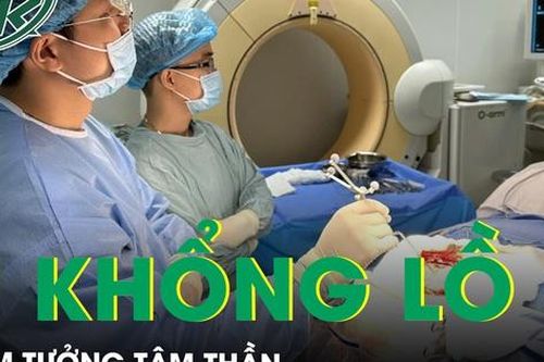 Mắc u não lầm tưởng bị tâm thần
