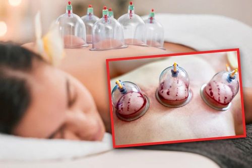Một phụ nữ Trung Quốc nhập viện sau khi hút 200 ml máu mỗi tuần