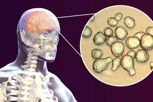 Triệt tiêu khả năng kháng thuốc của nấm gây viêm màng não