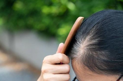 Vì sao người trẻ tóc bạc sớm?