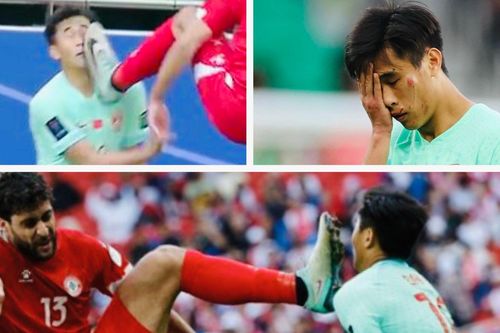 Cầu thủ Trung Quốc mặt rớm máu vì lĩnh trọn gầm giày của đối phương