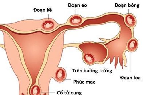 Khi thai nhi nằm sai vị trí