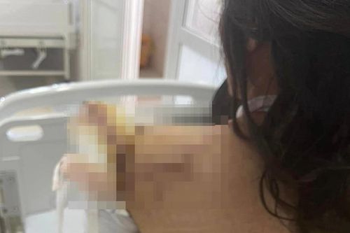 Truy bắt đối tượng nhiều lần tấn công người phụ nữ ở Đắk Lắk
