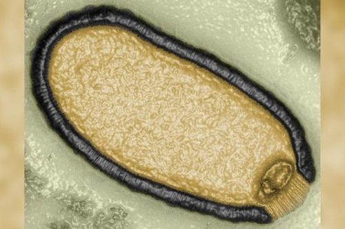 Virus Zombie ở Siberia có thể gây ra đại dịch nguy hiểm mới?