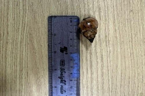 Người đàn ông trẻ hôn mê sau ăn một con ốc