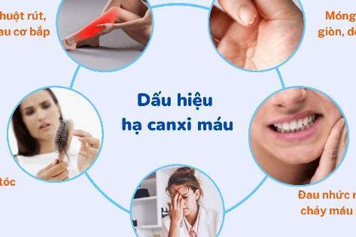 Thuốc loãng xương prolia làm tăng nguy cơ hạ canxi máu nặng