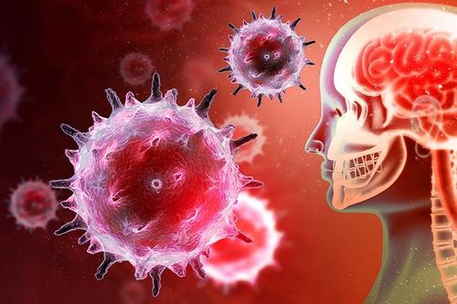 Dấu hiệu cảnh báo viêm não do virus