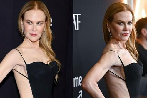 Nicole Kidman bị chê khi mặc váy táo bạo ở tuổi 57