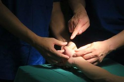 Thực hiện thành công ca tạo hình chi đầu tiên ở Hải Phòng