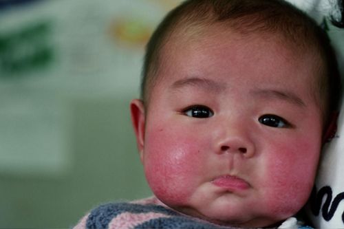 Miền Bắc vào đợt rét đậm, mẹ cần lưu ngay 5 bí quyết từ tự nhiên giúp bé không bị nứt nẻ, 'má đỏ cà chua'