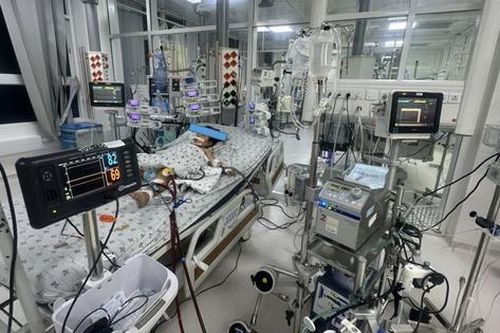 Bé gái 5 tuổi được phát hiện viêm cơ tim tối cấp sau vài ngày sốt nhẹ