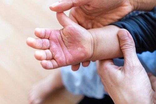 Tin tức Đời sống 24/1: Phòng ngừa tai nạn thương tích cho trẻ dịp Tết